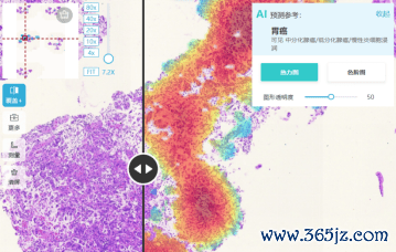 图：华银康胃活检AI扶植会诊系统